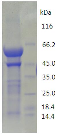 15% SDS-PAGE analysis profiles of purified KP1_1632-23-597 (CBB stained).